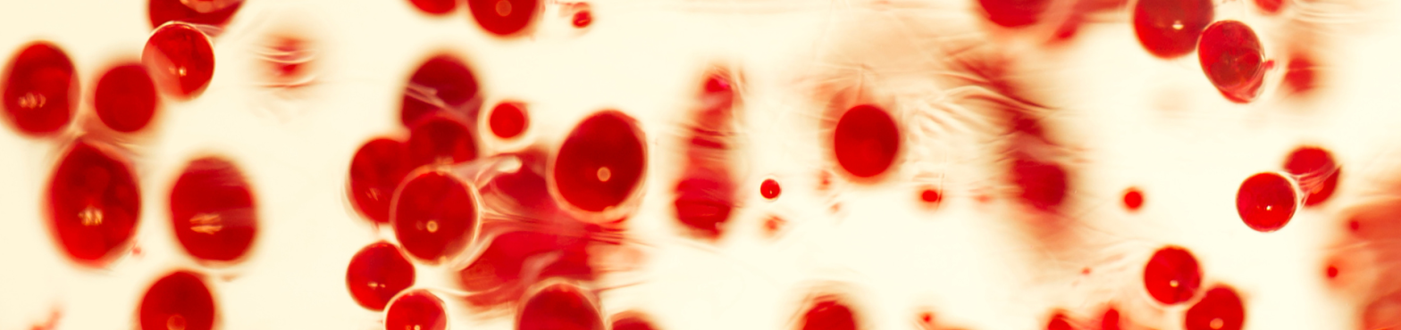mpox