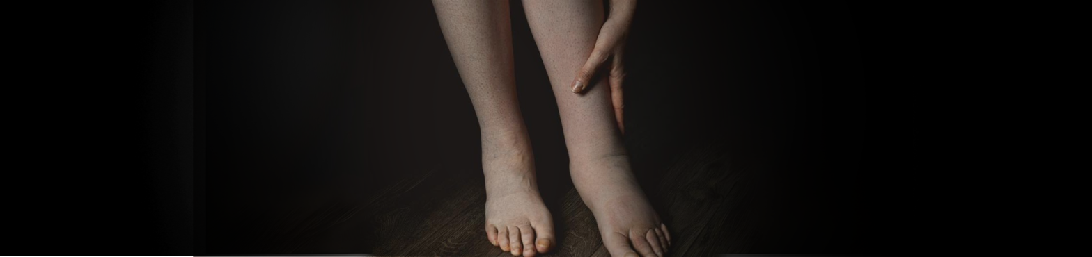 DVT Treatment in Abu Dhabi - Reem Hospital